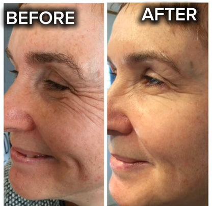 24K Gold Energy Beauty Bar Electric Facial Massage Roller