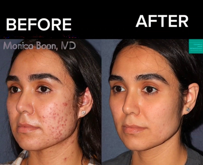 24K Gold Energy Beauty Bar Electric Facial Massage Roller