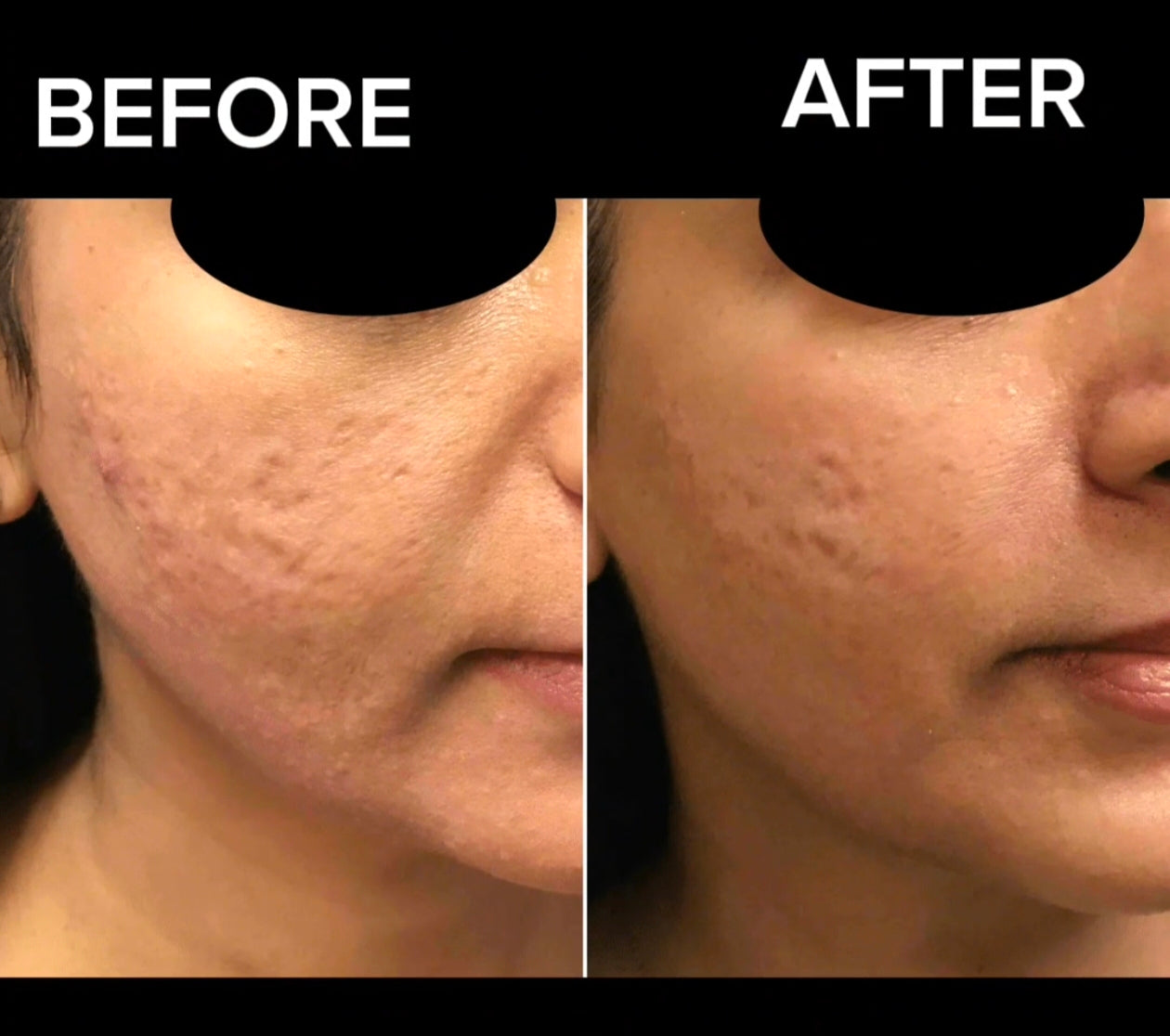 24K Gold Energy Beauty Bar Electric Facial Massage Roller